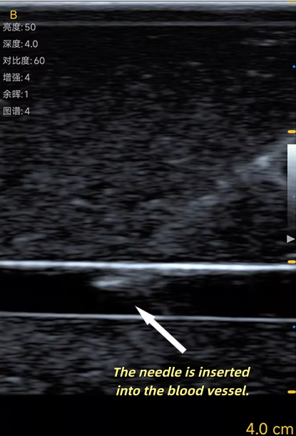 Model Pelatihan Pungsi Vaskula - Medical Gel Ultrasound ulasan dan harga